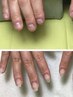 むしり癖・二枚爪【お爪が弱くコンプレックスのある方】クリアジェル仕上げ