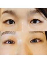 プライベイトスペース コト(PRIVATE SPACE COTO)/ダブルアイリフト