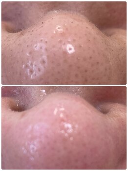 プアラ(puala)/鼻先、注目!キレイに変身!