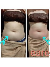 エアレ(eare)/before、after