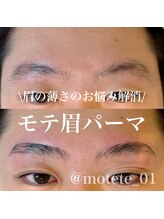 モテテ(motete)/お客様施術例☆栄本店