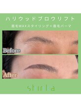 シンカ 湘南江ノ島 鵠沼(shinka)/【HBL】Before/After