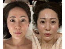 メナードフェイシャルサロン 宮の沢の雰囲気（厚生労働省認可の最強シワケア♪いつまでも若々しい美肌へ★）
