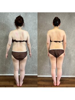 アーマンクラージュ(Ahmen Courage)/ブライダルエステ【赤羽】