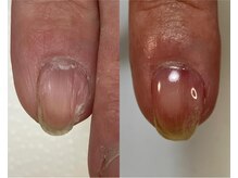 ロンディネ(Rondine)/自爪育成