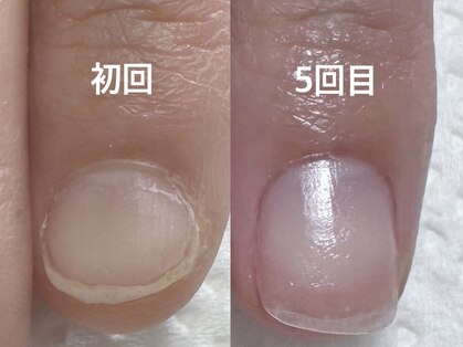 アメジスト(Amethyst)の写真