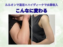 ヨサパーク フラネ(YOSA PARK Flaner)の雰囲気（回数を重ねると気になる部位のむくみが取れてどんどん身体が変化）