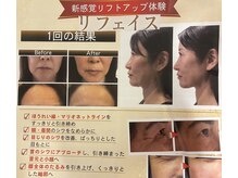 ミナミナ(MINA MINA)の雰囲気（宮城県初!リフェイス結果重視の最新リフトアップ&エイジングケア）
