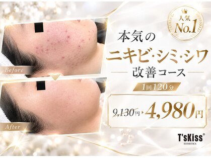 ティーズキッス(T’s Kiss)の写真
