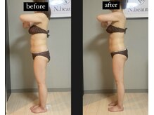 エヌボーテ(N. beaute)/before→after全身コース一回目