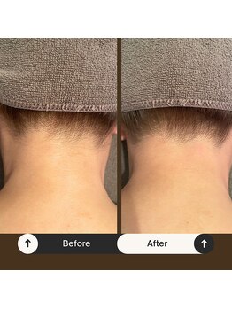 チャンティック(Cantik)/意外と生えているうなじ・・・。