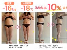 横倉整体院の雰囲気（産後の体型戻し！キャビテーションでボディラインを整えます！）