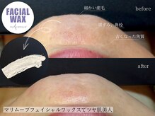 アルビレオ(Albireo)