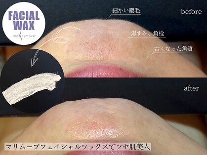 アルビレオ(Albireo)の写真