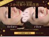 今だけ限定残り2名！【2か月集中】美肌トライアルモニター募集中