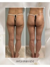 バステト(BASTET)/30代お客様