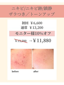 ナーズプラス リベルテ(Naz Plus/Liberte)/