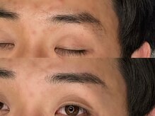 ブラン 新宿店(BLANC)/新宿の眉毛・アイブロウはブラン