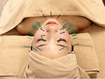 カイ(Kai)の写真/【オーダーメイド美容鍼】たるみ・むくみ・肌荒れを根本改善!内側から輝くようなハリツヤ肌へ☆