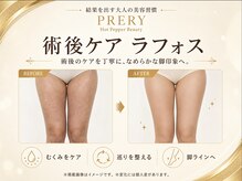 プレリー 自由が丘店/術後のむくみケアにラフォス