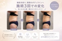 シュシュ(chouchou)