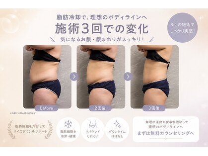 シュシュ(chouchou)の写真