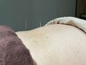 ボディケア鍼灸