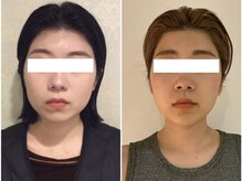 ウェリナ平和堂長久手院/小顔矯正/骨盤矯正/痩身/整体