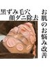 黒ずみ毛穴、顔脱毛、顔ダニ除去で肌管理★フェイシャルワックス