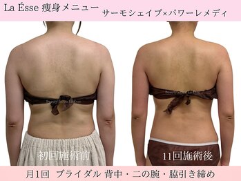 ラエッセ(La Esse)/*ブライダル*ドレス映えする背中