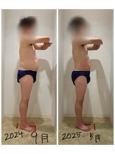 未来型スパエステ サリスパ(SARI SPA)/ビフォーアフター