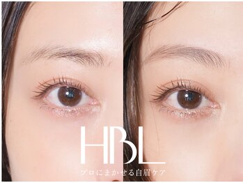 リンネ(Rinne)/【HBL】before/after