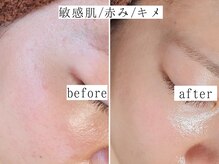 ユウビジン(YOU美人)/