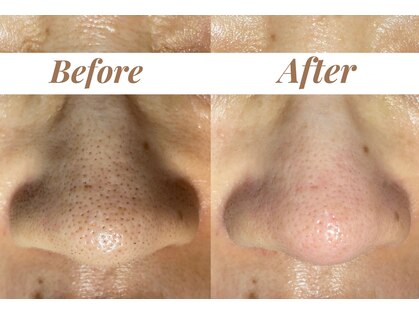 シェリール(Cherir)の写真