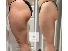 ソナ 大和西大寺院(SONA)/