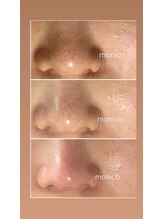 モニコ(monico)