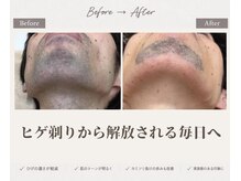 モット いこらもーる泉佐野店(mot)の雰囲気（エステティック認証機器の純国産機械を使用。メンズ専用も。）