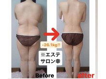エステサロン 幸