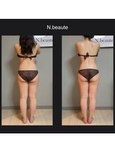 エヌボーテ(N. beaute)/before→ after全身コース一回目