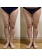 カロン(kalon)の写真/【筋膜リリースでスッキリ美脚☆】筋膜やリンパにしっかりアプローチし、スラっとした美脚に◎