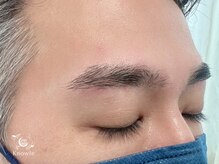 ノウル(Knowle)/メンズ/美眉/ワックス脱毛