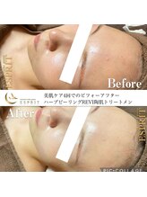 エスプリ 銀座店/ハーブピーリング銀座