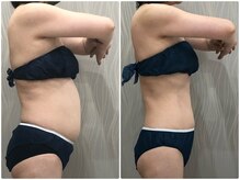 40代からのくびれ痩身！代謝アップ痩せやすい体質へ