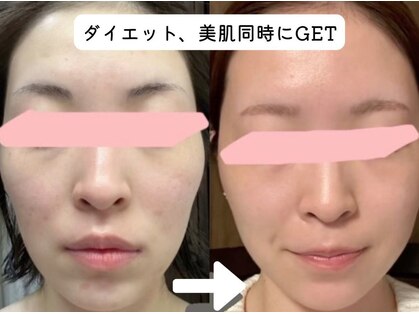 ヨサパーク ベアトリーチェ(YOSA PARK beatrice)の写真