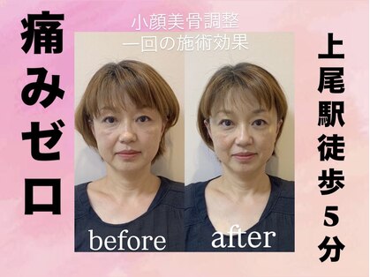 セラピーインカローズの写真