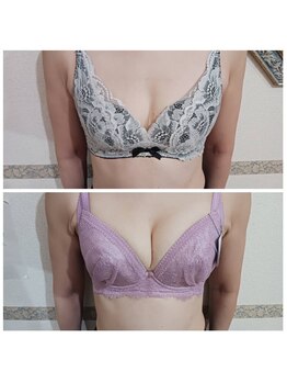 メディカルエステ ユウ(Yuu)/バストアップ専門店です