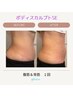 《電磁パルスボディスカルプト1部位》平日11時～16時入店or2週以内★¥6,800→