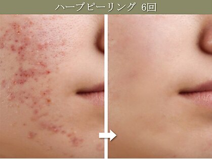 椿(TSUBAKI)の写真