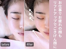 アキュベル 薬院(Acubelle Yakuin.)