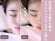 アキュベル 薬院(Acubelle Yakuin.)の写真